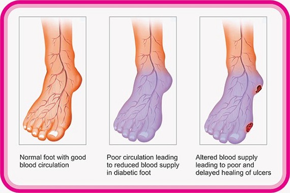 Circulatory System Balance Harmony Wellness Inc 